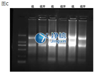 组织匀浆器对人结肠癌研磨效果